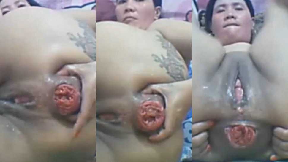 熟女妈妈超重口屁眼拳交①肛门脱肛 肠子都翻出来了 肛门玫瑰大开 废了-变态..